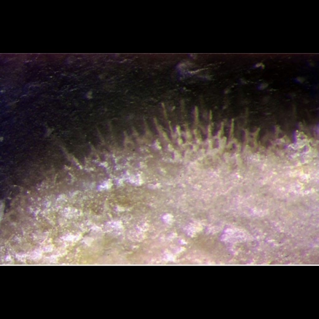 Kalkschwamm Porosphaera Globularis Mit Stacheln, 5mm